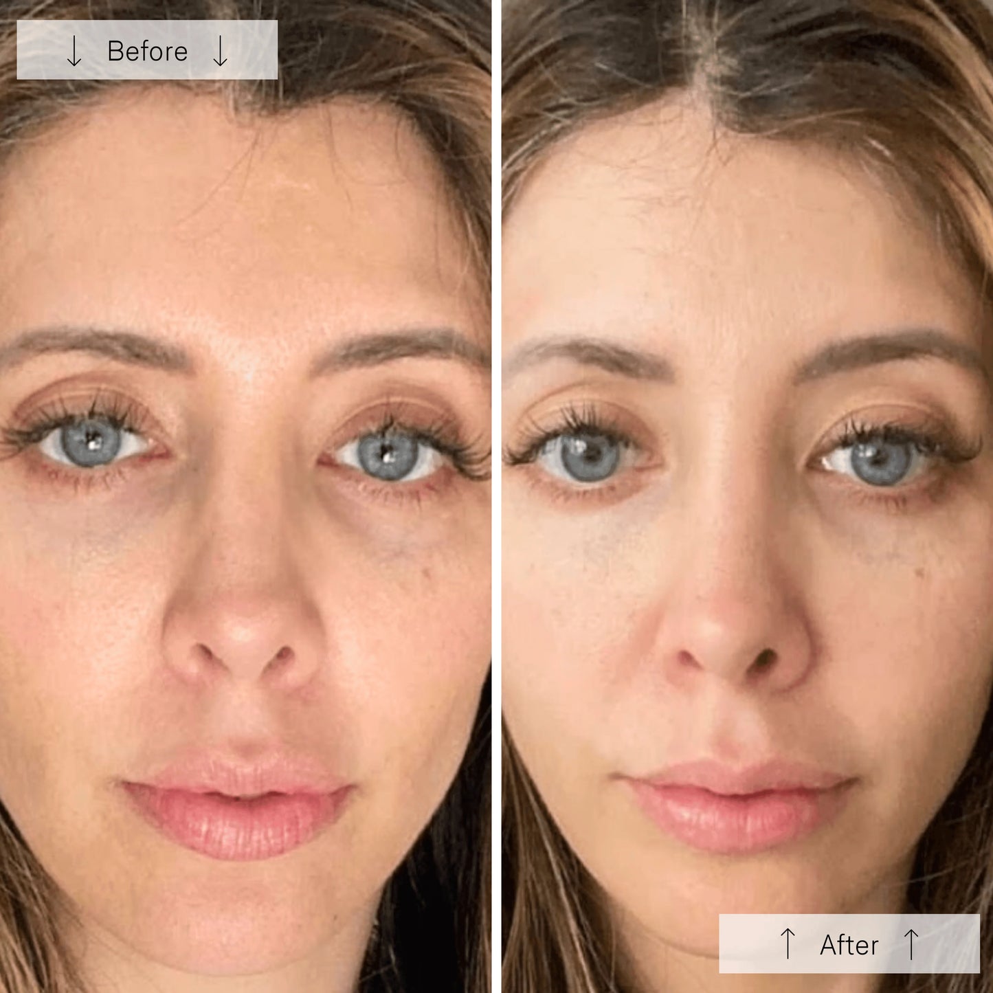 Silicone Face Mask