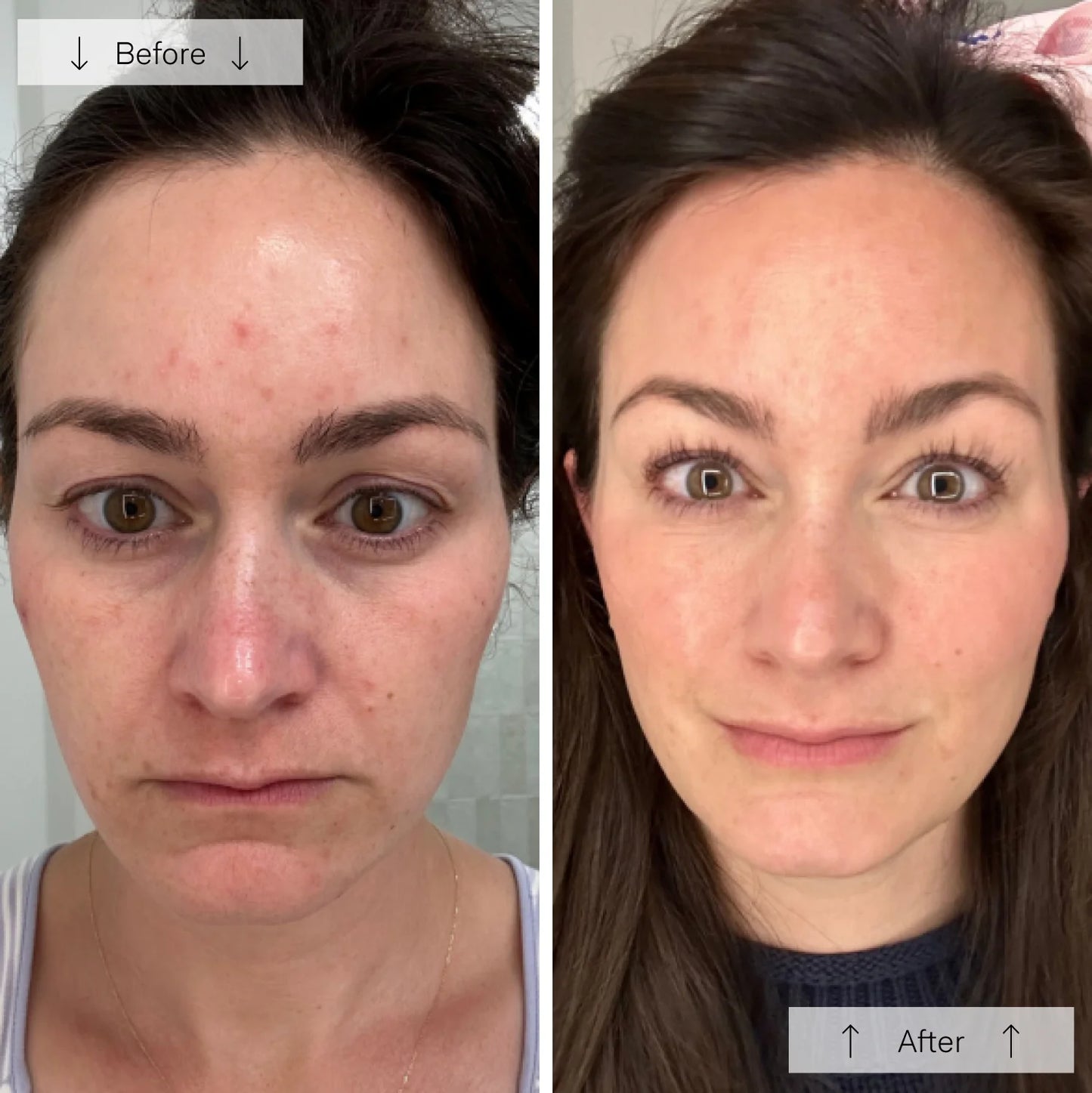 Silicone Face Mask