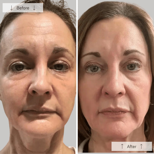 Silicone Face Mask